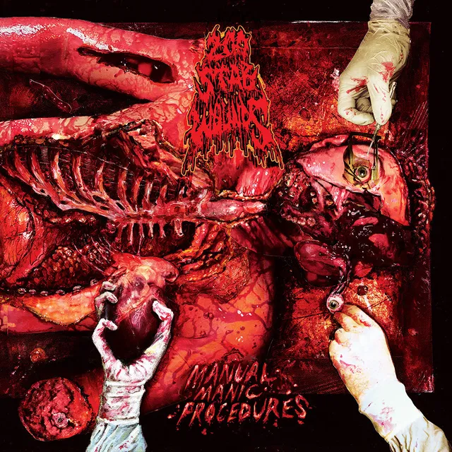 200 Stab Wounds Manual Manic Procedures LP 180g svart