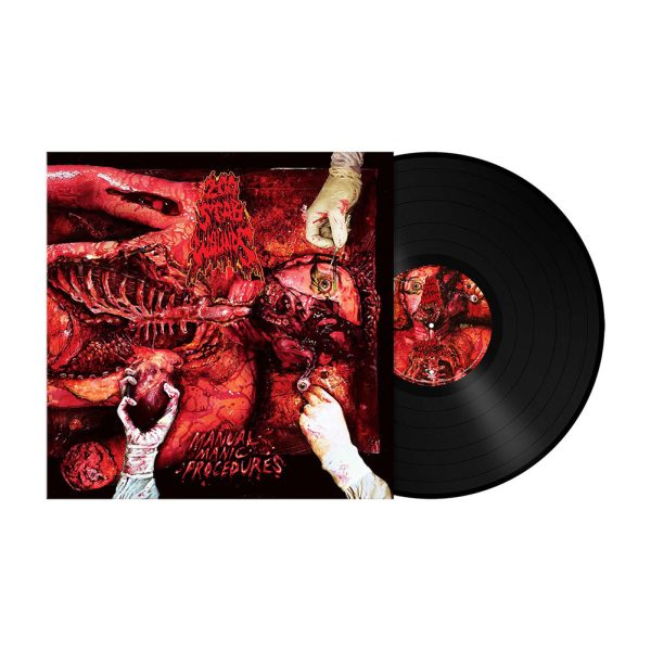 200 Stab Wounds Manual Manic Procedures LP 180g svart